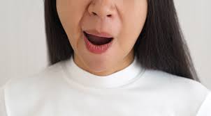 Bibir sebelah kiri bawah : Penyakit Bell S Palsy Gejala Penyebab Dan Cara Mengobati Halodoc Com