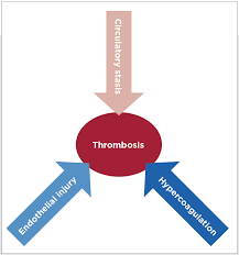 Image result for Hypercoagulable