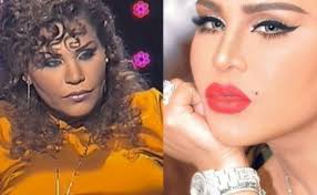 أصالة نصري خضعت للعديد من عمليات التجميل. ØµÙˆØ± ØµØ§Ø¯Ù…Ø© Ù„ÙÙ†Ø§Ù†Ø§Øª Ù‚Ø¨Ù„ ÙˆØ¨Ø¹Ø¯ ØªÙƒØ¨ÙŠØ± Ø´ÙØ§Ù‡Ù‡Ù† Ø§Ù„Ù…Ø¯ÙŠÙ†Ø© Ù†ÙŠÙˆØ²