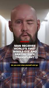 Aaron James Accident Before Transplant