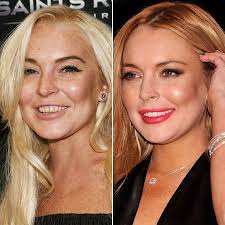 Celebrity Teeth: Before And After