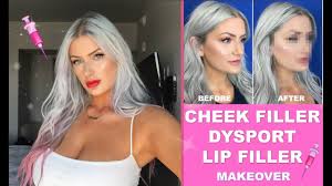 Thomas loeb, a new york city board certified plastic surgeon. The Results Are Insane I Get Cheek Filler Dysport For The First Time Youtube