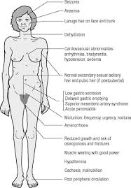 Along with the lack of necessary nutrients, bulimia is also a known cause of a condition called telogen effluvium, which leads to hair loss following emotional or physical stress or trauma. Eating Disorders Neupsy Key