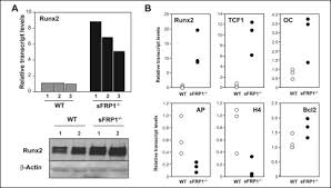 Replacement aluminum upper s' rod for whites coinmaster, coinmaster pro, prizm 2, 3, 4, and 5g metal detectors. Canonical Wnt Signaling Promotes Osteogenesis By Directly Stimulating Runx2 Gene Expression Journal Of Biological Chemistry