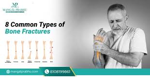 Image result for Fracture Types