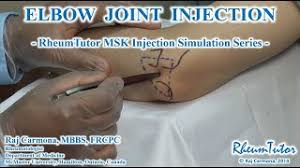 Image result for Elbow Joint Injection