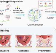 Drug-free and non-crosslinked chitosan/hyaluronic acid ...