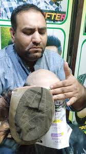 Swiss Lace Hair Patch: Transform Your Look for RS.20000