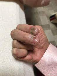 60歲加藤鷹現況曝光金手指「紅腫發黑」整組害了了| 娛樂| CTWANT