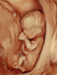 Ultrasound dimensions is the finest diagnostic center in noida, providing 3d &4d scan, color doppler, and sonography services that are performed by radiologist dr. Prices