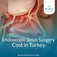 Image result for Sinus Surgery