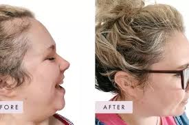 Britain's Got Talent and Emmerdale stars join line-up for Layton Christmas  lights Switch On