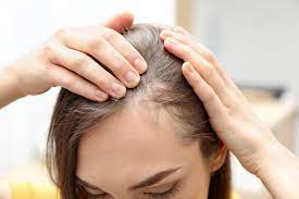 Stress can contribute to hair loss and more. 19 Causes Of Hair Loss How To Treat It Health Com