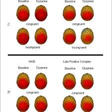 Image result for Ceropegia stenantha
