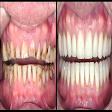 Teeth restoration product image