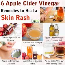 Virgin coconut oil is becoming a favorite in spa treatments for skin health. 6 Apple Cider Vinegar Remedies To Heal A Skin Rash Top 10 Home Remedies