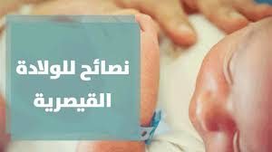 هنالك نوعان أساسيان من هذه الولادة القيصرية، بحسب نوع الشق، كما يأتي: Ø§Ù„ÙˆÙ„Ø§Ø¯Ø© Ø§Ù„Ù…Ù†Ø²Ù„ÙŠØ© Ø®Ø·Ø± ÙƒØ¨ÙŠØ± Ø£Ù… Ø°ÙƒØ±Ù‰ Ø±Ø§Ø¦Ø¹Ø© Ø­Ù…Ù„