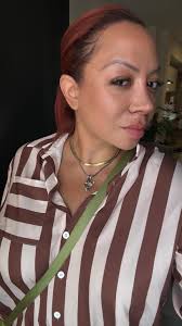 Hey! I had my nose done in April. My tip is very lifted and grafted. Would  any of you be kind enough to share before/after photos of your nasal tip  that dropped