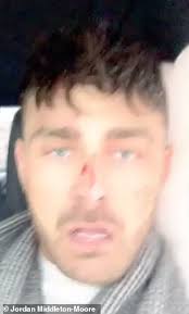 Driver survives after 6ft fence post skewers his windscreen in snow