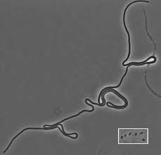 Escherichia coli (/ˌɛʃəˈrɪkiə ˈkoʊlaɪ/), also known as e. Une Bacterie Mutante D Escherichia Coli Devient Geante