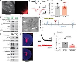 Machen sie sich keine sorge, denn bei unserer webseite ist die komplettlösung vom spiel ein sehr ähnliches spiel mit dem brain out, doch die fragestellung hier ist ganz anders formuliert. Rapid Purification And Metabolomic Profiling Of Synaptic Vesicles From Mammalian Brain Elife