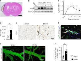 Neutrophil Extracellular Traps Released By Neutrophils Impair Revascularization And Vascular Remodeling After Stroke Nature Communications