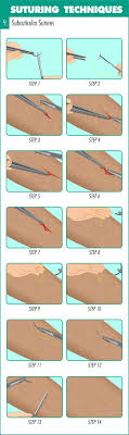 complete guide to mastering suturing techniques