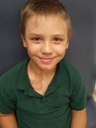 ALDEN UPDATE DAY 77 (Sept. 11, 2019) From Darrell: Our trip to Portland and  Alden's checkup went very well. This was a quick trip with just Alden and  me. We drove over