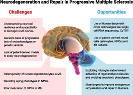 Tap here to learn more. New Age For Progressive Multiple Sclerosis Pnas