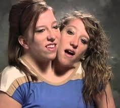 Inside Abby Hensel's Husband Joshua Bowling's First Marriage