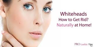 Home remedies for getting rid of whiteheads is to use sandalwood paste made with rose water. 10 Quick And Natural Ways To Remove Whiteheads