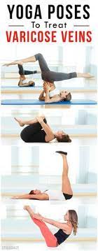 Yoga poses for varicose veins. Varicose Veins