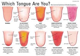 Black And White Spots On Tonsils Detox Your Mouth For Whole Body Health Health Wellness Body Hacks Alternative Health Body Health