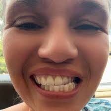 Looking to start a class action lawsuit against Aspen dental in Ft Myers  Florida We need to stop them