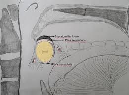 Image result for tonsilla palatina