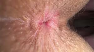 💎brilliant Young Girl Made Teeth Pumped Nipples and Wiped Butthole for  Woodman Casting