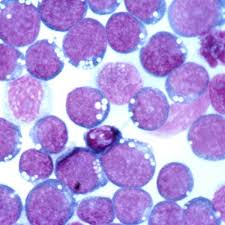 Einleitung rote flecken am gaumen entstehen aufgrund von unterschiedlichen krankheiten und können somit ein hinweis auf verschiedene erkrankungen sein. Epstein Barr Virus Ebv Naturheilzentrum Breidenbach