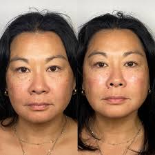 Nadia Ryan RN, BSN (@nadiaryan.rn) • Instagram photos and videos