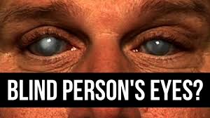 Hello, cj, do you know the origin of go troppo? Can Blind People Open Their Eyes Youtube