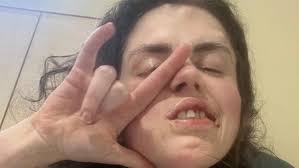 Fundraiser for Jessica Lawrence by Jessica Lawrence : A Cry For Help For  Jess