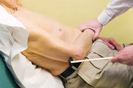 Image result for Reflex Exam