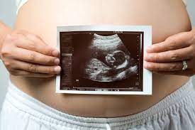 How ultrasounds are shaping women's views on abortion