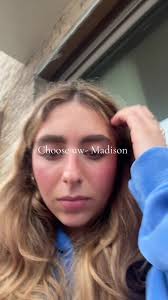 Matthew Friedman Uw Madison