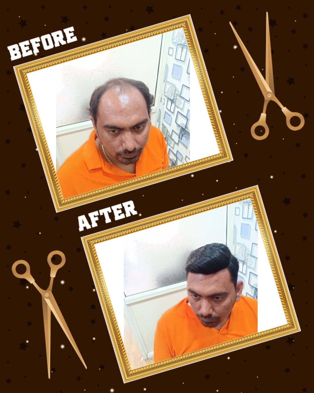 Hair patch product image
