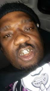 Gold Grills by flocca