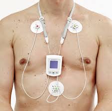 Zunächst werden elektroden auf der haut fixiert. Leistungen Kardiologie Am Kleistpark