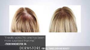 Made by a brand that has been making products for thinning hair for more than 25 years. The Best Treatment For Thinning Hair Youtube