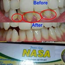 Jual Nasa Pasta Gigi Online Desember 2020 Blibli