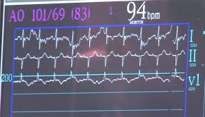 improving cath lab efficiency with todays hemodynamic