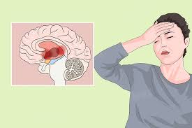 下丘脑分泌的激素-有来医生